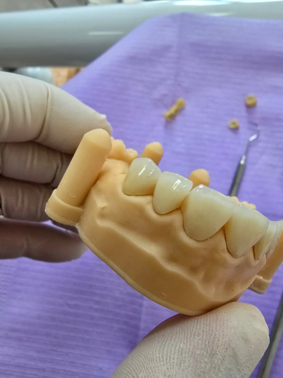 Diş hekimi konsültasyon